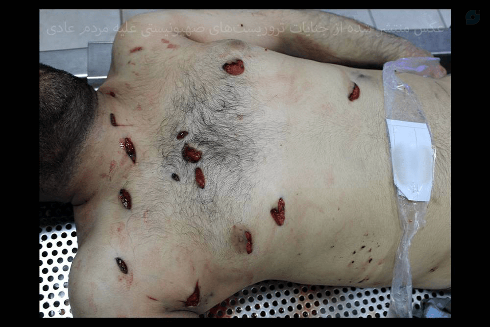 قتل عام مردم ایران توسط عوامل موساد