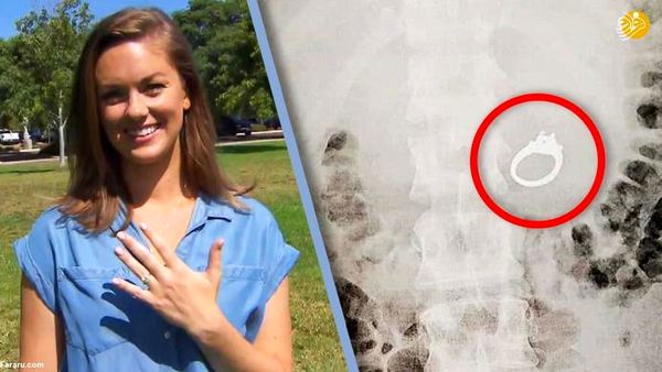 حلقه نامزدی این زن برایش مشکل ساز شد + عکس