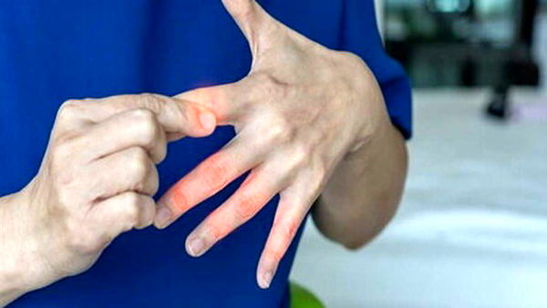 یک هشدار جدی درباره بی حسی و درد انگشتان