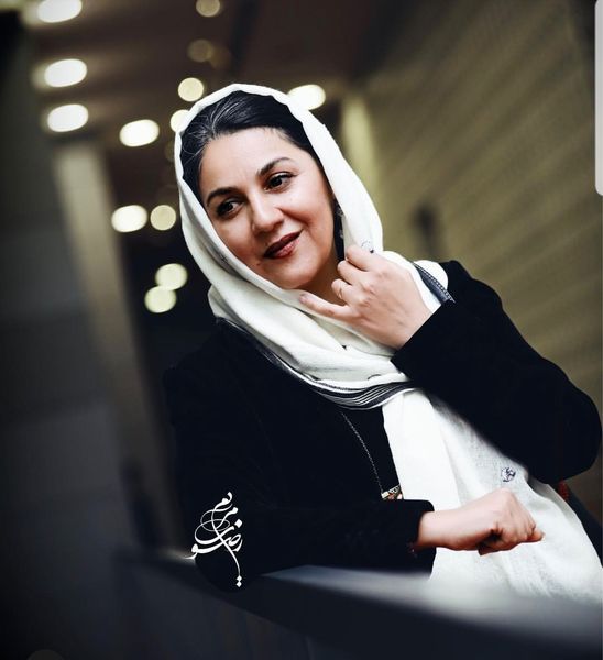 تار موهای ستاره اسکندری سفید شد + عکس