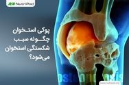 چرا سلامت استخوان‌ ها در سنین پایین به چالشی جدی تبدیل شده است؟