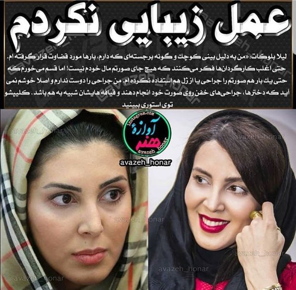 عمل زیبایی لیلا بلوکات + عکس