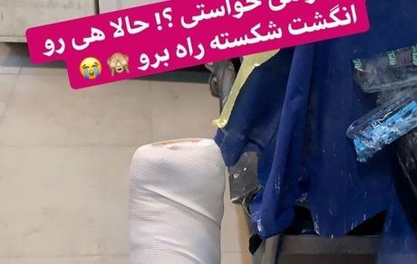 وقتی پای خانم بازیگر تو گچ میره + عکس