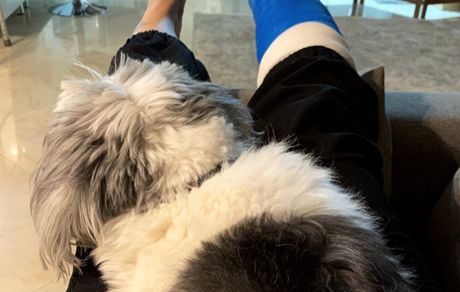 خانم بازیگر با پای شکسته اش+ عکس