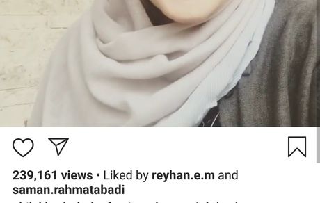 صورت پف کرده شیلاخداداد در تراس خونشون+ عکس