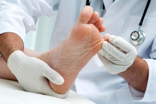 گرم کردن مچ پا پیچ خورده اشتباه است