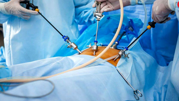 مرگ یک عرب‌ هنگام لیپوساکشن در مشهد