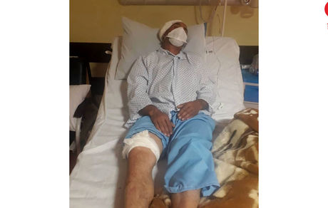 خرس وحشی مرد روستایی را در بروجن درید + عکس
